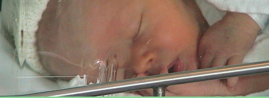 5 Signs your Cerebral Palsy Baby Suffered from Preventable Birth Asphyxia