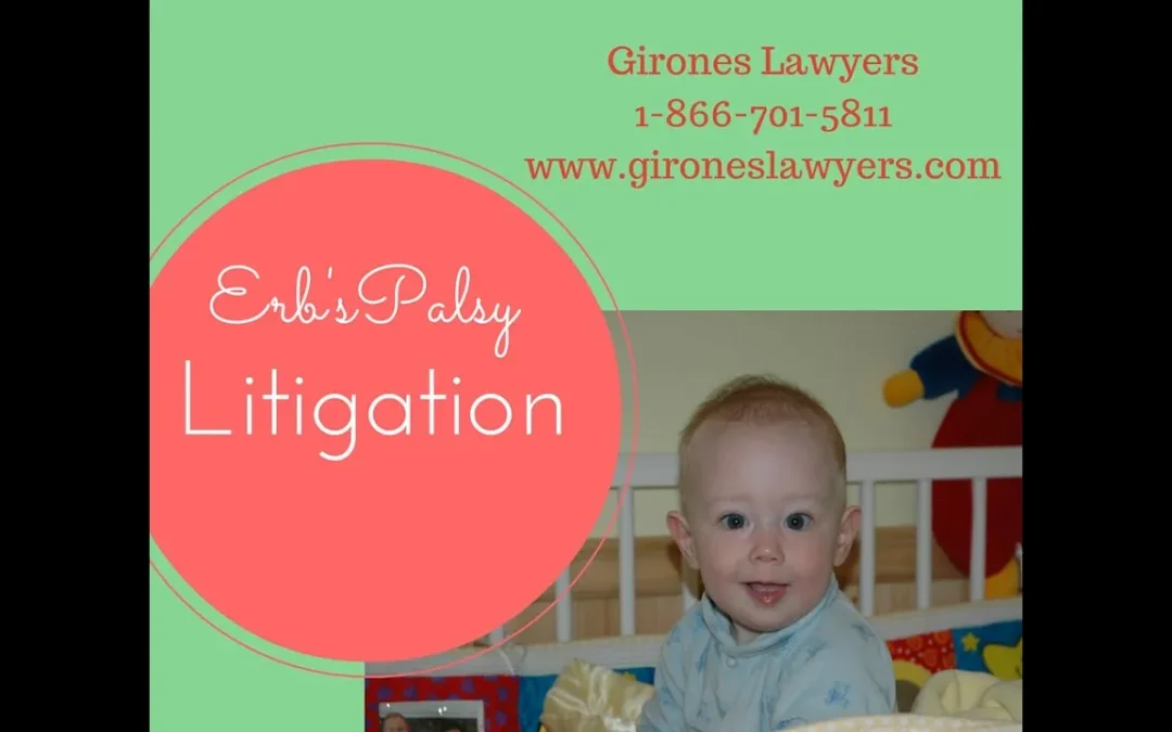 How Erb’s Palsy can be caused by negligence at birth